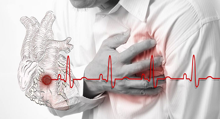 สัญญาณและอาการโดยทั่วไปของโรคหลอดเลือดหัวใจ